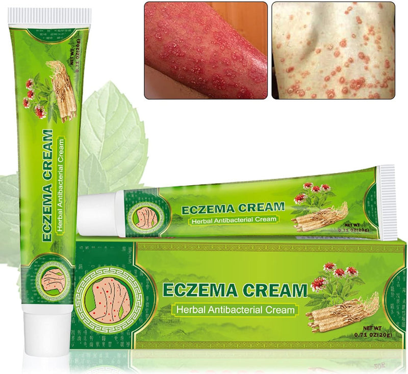 Herbal Antibacterial Eczema Relief Cream 20g