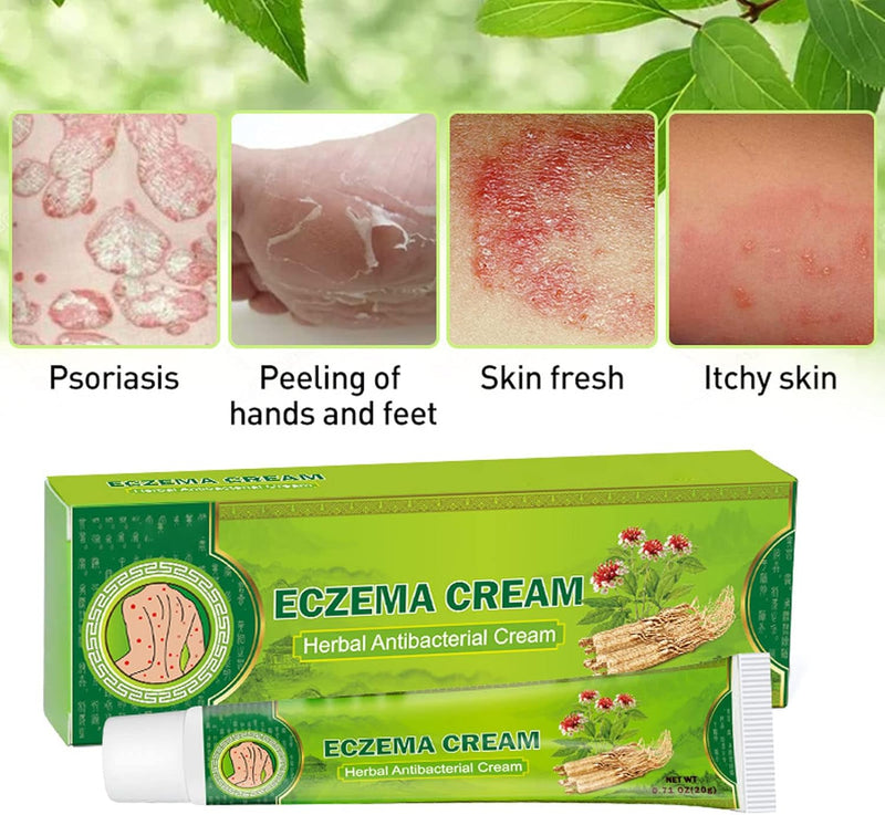 Herbal Antibacterial Eczema Relief Cream 20g