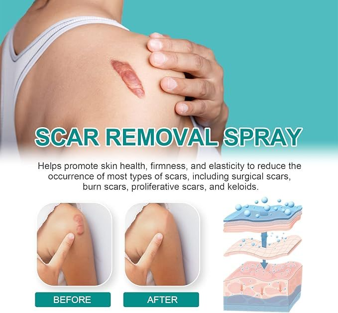 Medical Scar Care Removal Spray