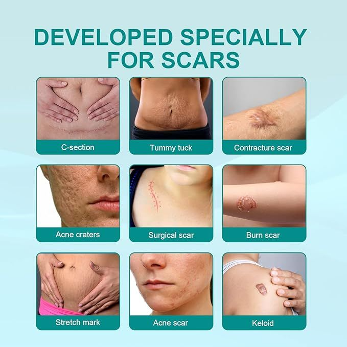 Medical Scar Care Removal Spray